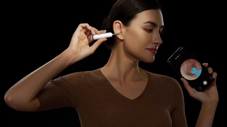 Bebird Home 30S: Versatile Ear Camera with Fluid Application and Hygiene on Gadget Flow